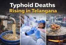 Typhoid Deaths Rising in Telangana, Health Experts Sound Serious Warning
