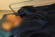 Miyapur Iron Gate Accident: 4-Year-Old Boy Dies After Gate Falls on Him in Hyderabad Colony