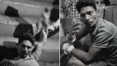 Hyderabad Mobile Snatching Attack: Youth Injured in Mailardevpally Knife Assault, Accused on Run