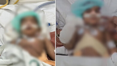 Hyderabad Milestone: 18-Month-Old Child Undergoes 14-Hour Liver Transplant at Osmania General Hospital