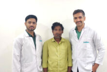 Kamineni Hospitals Reconstructs Cancer Patient’s Jaw Using Leg Bone After 12-Year Gutkha Addiction