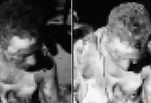 Congress Worker Set Ablaze in Alleged Murder Attempt in Warangal District