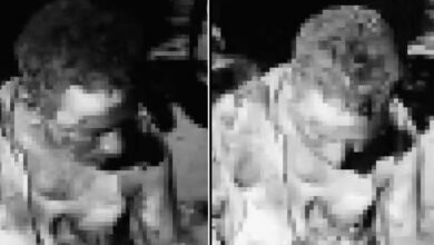 Congress Worker Set Ablaze in Alleged Murder Attempt in Warangal District