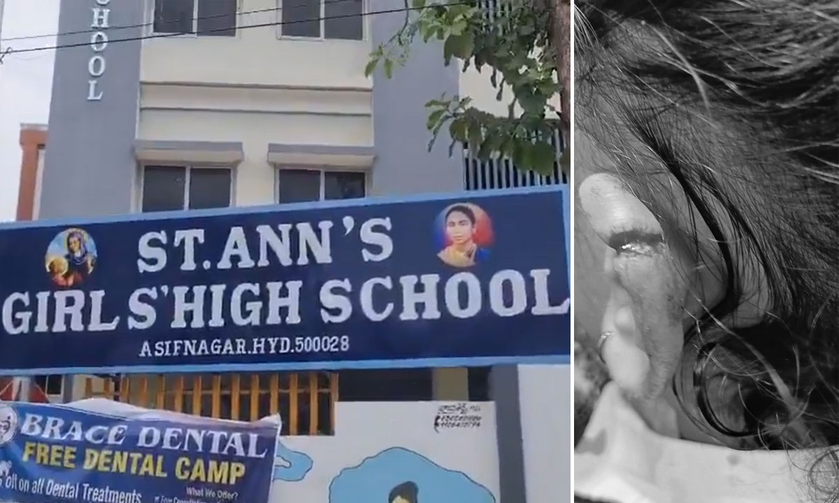 Hyderabad: UKG Student Gets Two Stitches After Teacher Allegedly Hit Her with Exam Writing Pad at St. Ann's Girls High School
