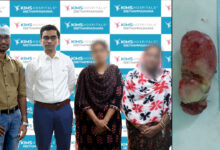 KIMS Doctors Remove 6-cm Oesophageal Tumour Through Mouth Without External Incision