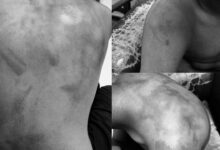 Class 10 Student Allegedly Brutally Assaulted at Sri Chaitanya Hostel, Critical