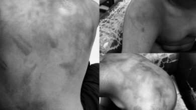 Class 10 Student Allegedly Brutally Assaulted at Sri Chaitanya Hostel, Critical
