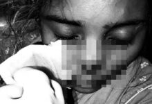 Man, Allegedly Cuts Off Wife’s Nose After She Refuses to Return Home