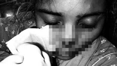 Man, Allegedly Cuts Off Wife’s Nose After She Refuses to Return Home